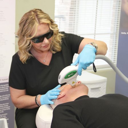 nurse uses icon laser on mans face.