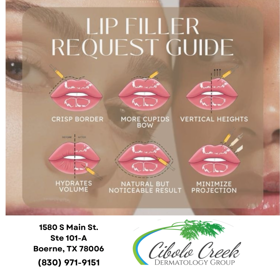 Lip Filler Request Guide Feb